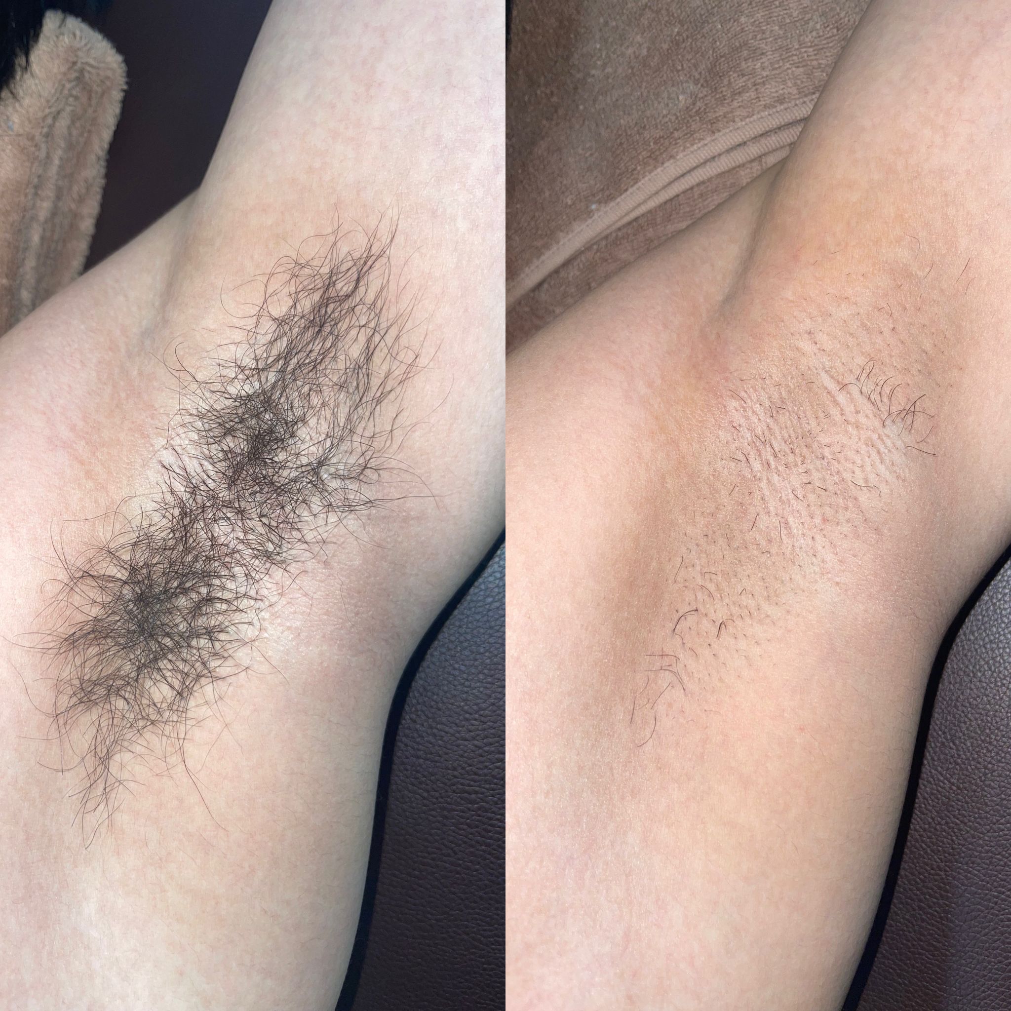 汗ばむ匂い対策、煩わしいケアも快適に♪の画像