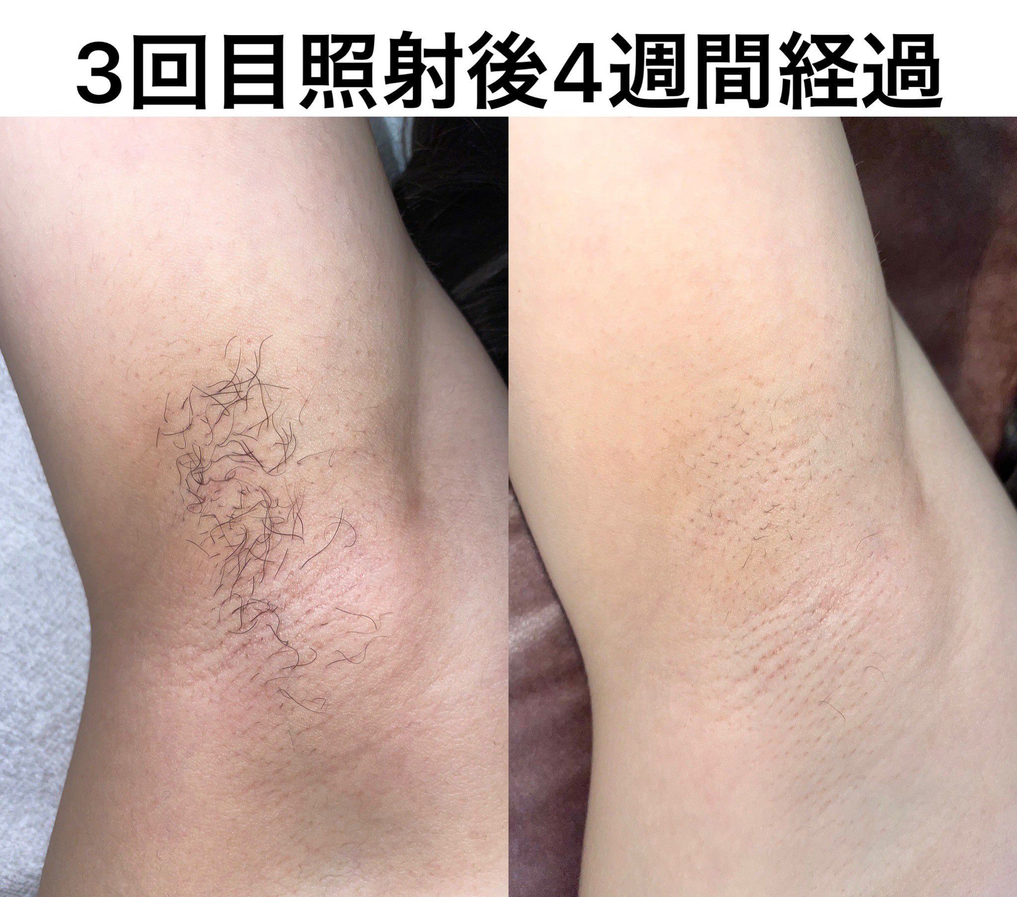 簡単な所は自分で♪慣れてる方に☆の画像